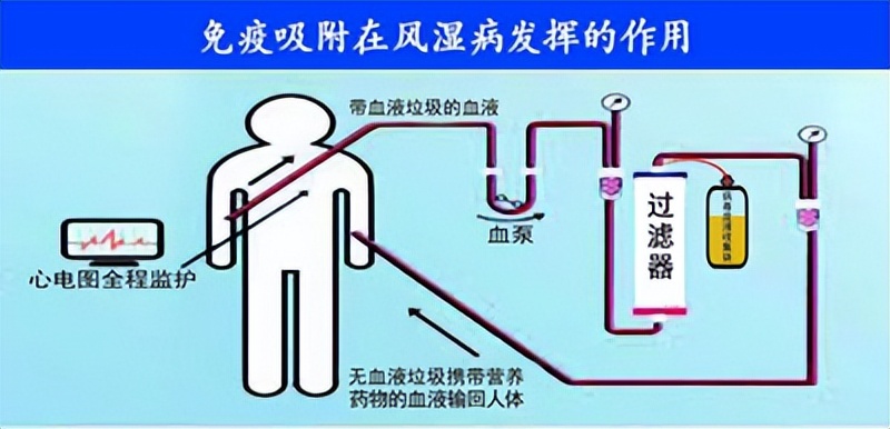 中药怎么调类风湿免疫紊乱,类风湿调免疫的药有哪些