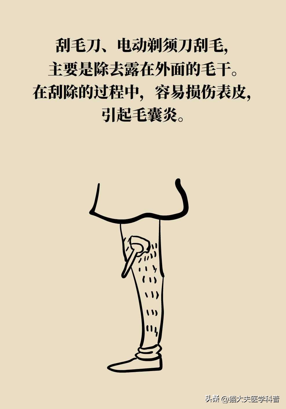 opt激光脱毛是永久的吗,激光男士脱毛永久简单方法