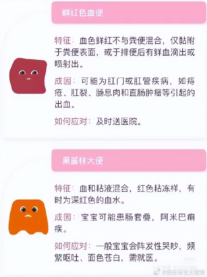 正常大便的颜色和性状怎么描述,新生儿大便颜色及性状变化