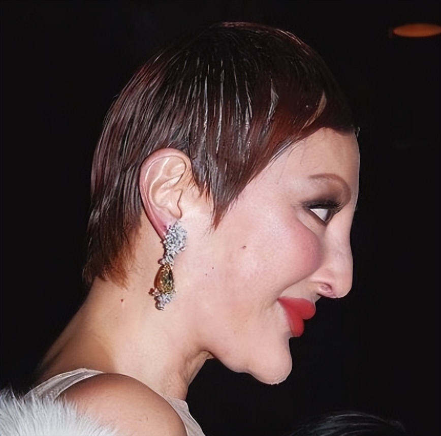 整容过度垮脸的女星,整容失败的蛇精脸女演员