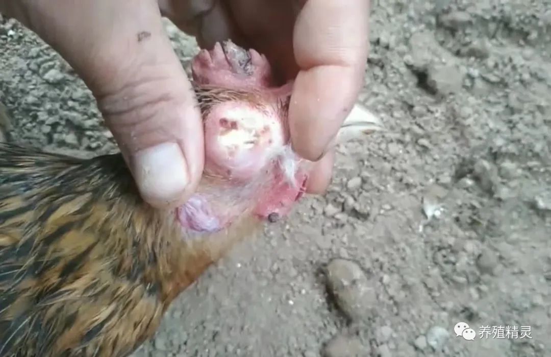 带你了解呼吸道病原体核酸检测,支原体肺炎症状