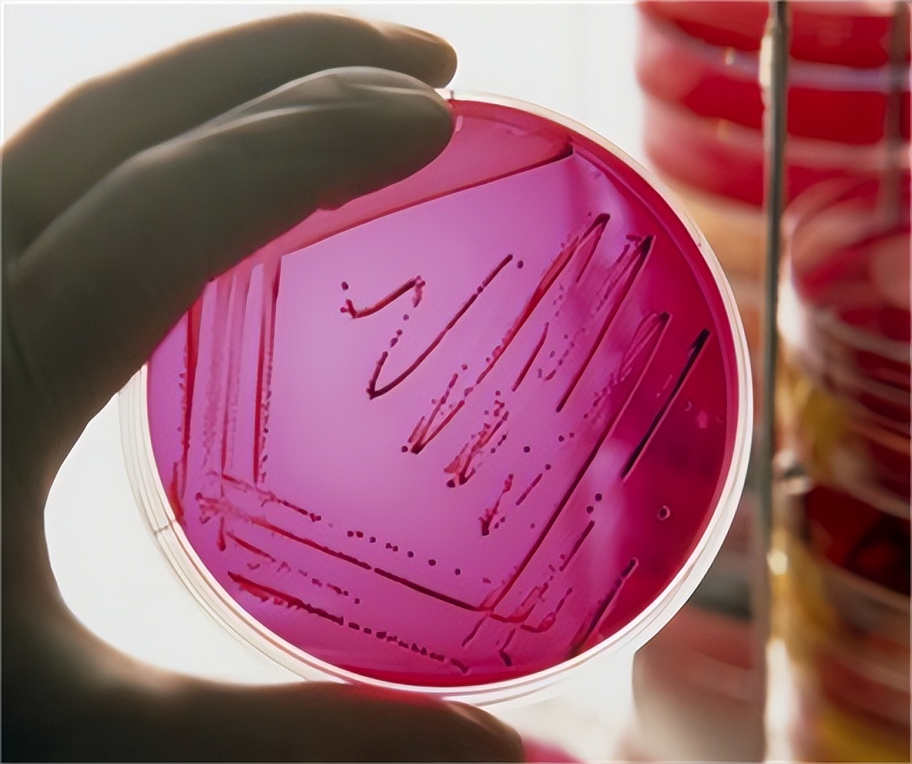 一直感觉大便拉不干净是怎么回事,大便感觉老是拉不干净是什么原因