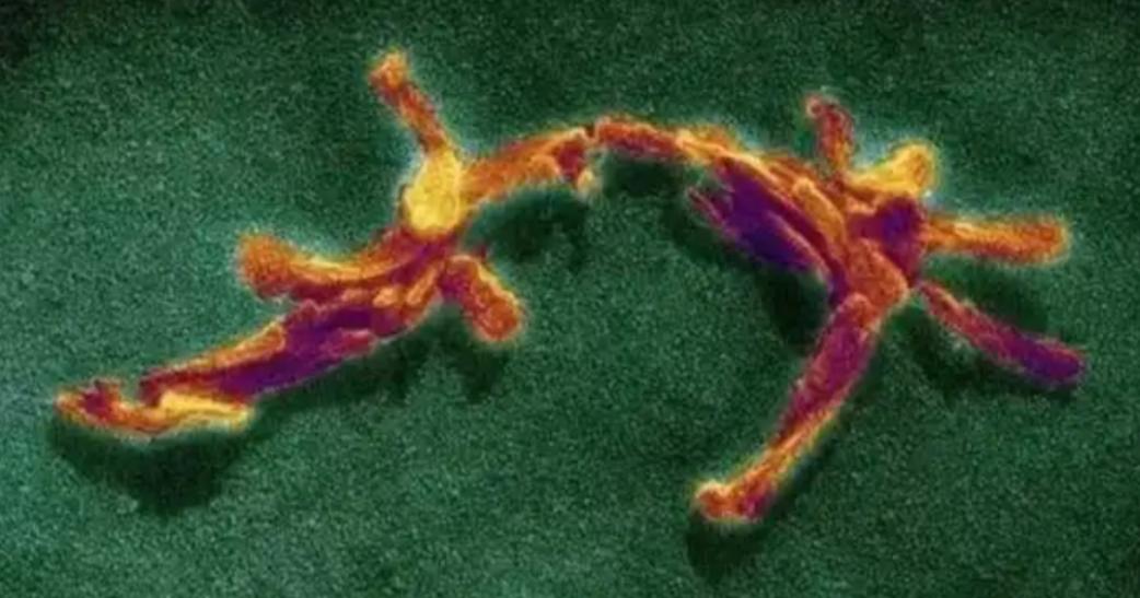 致死率100%！无药可救烹煮杀不死的朊病毒，感染后会有多恐怖？