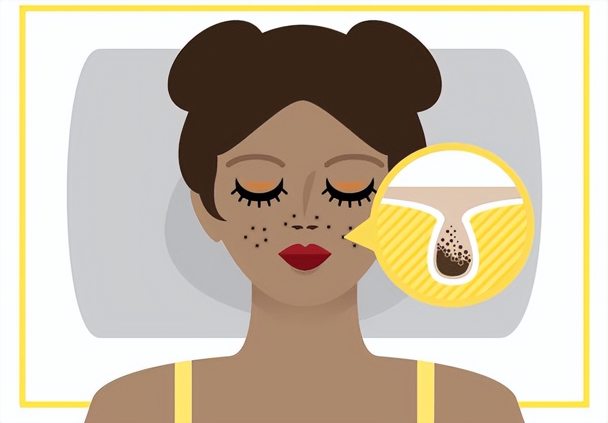 手臂毛孔堵塞怎么疏通最快最好,毛孔堵塞用什么药物可以疏通