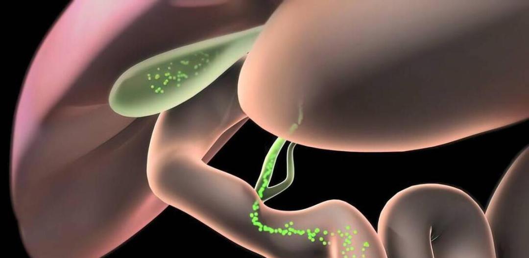 胆管癌手术后怎么预防复发,预防胆管癌的最好方法