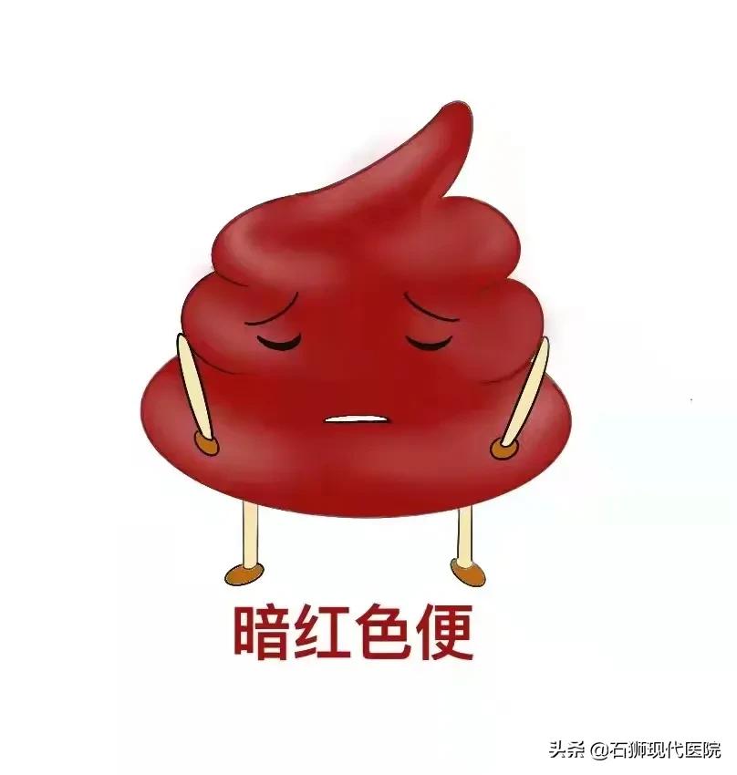 便血挂肛肠外科,便血一般肛肠外科怎么检查