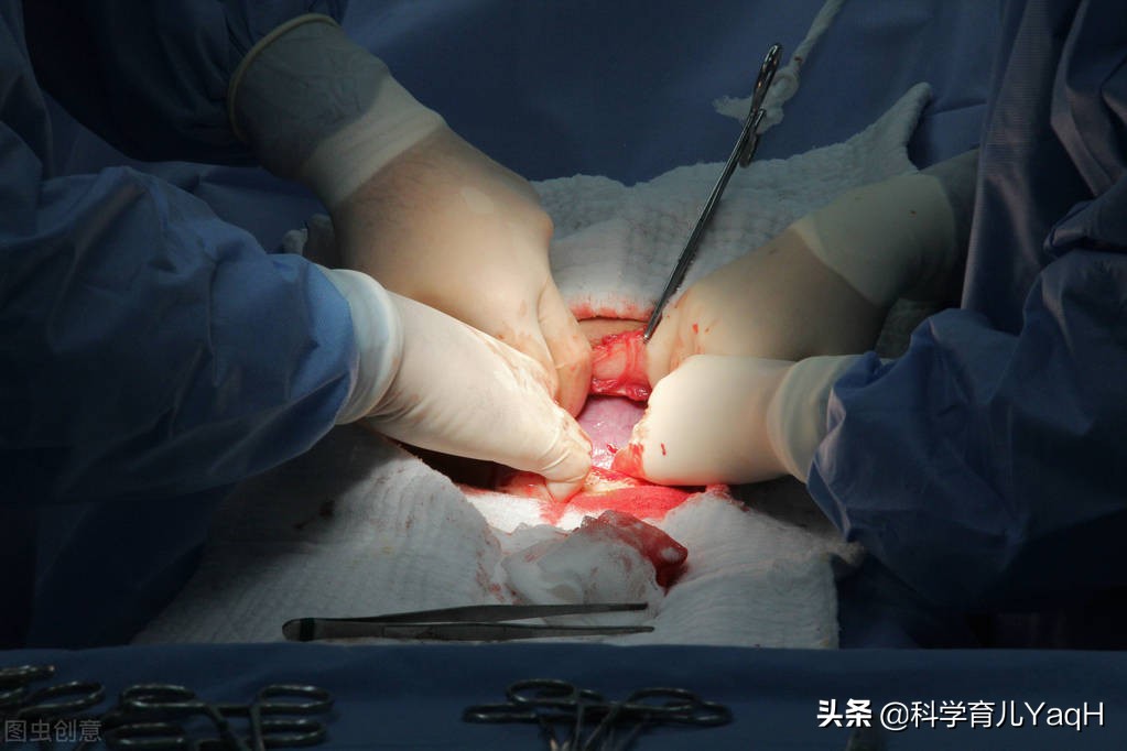 自然分娩几天以后可以正常饮食,自然分娩的常规护理及母乳喂养