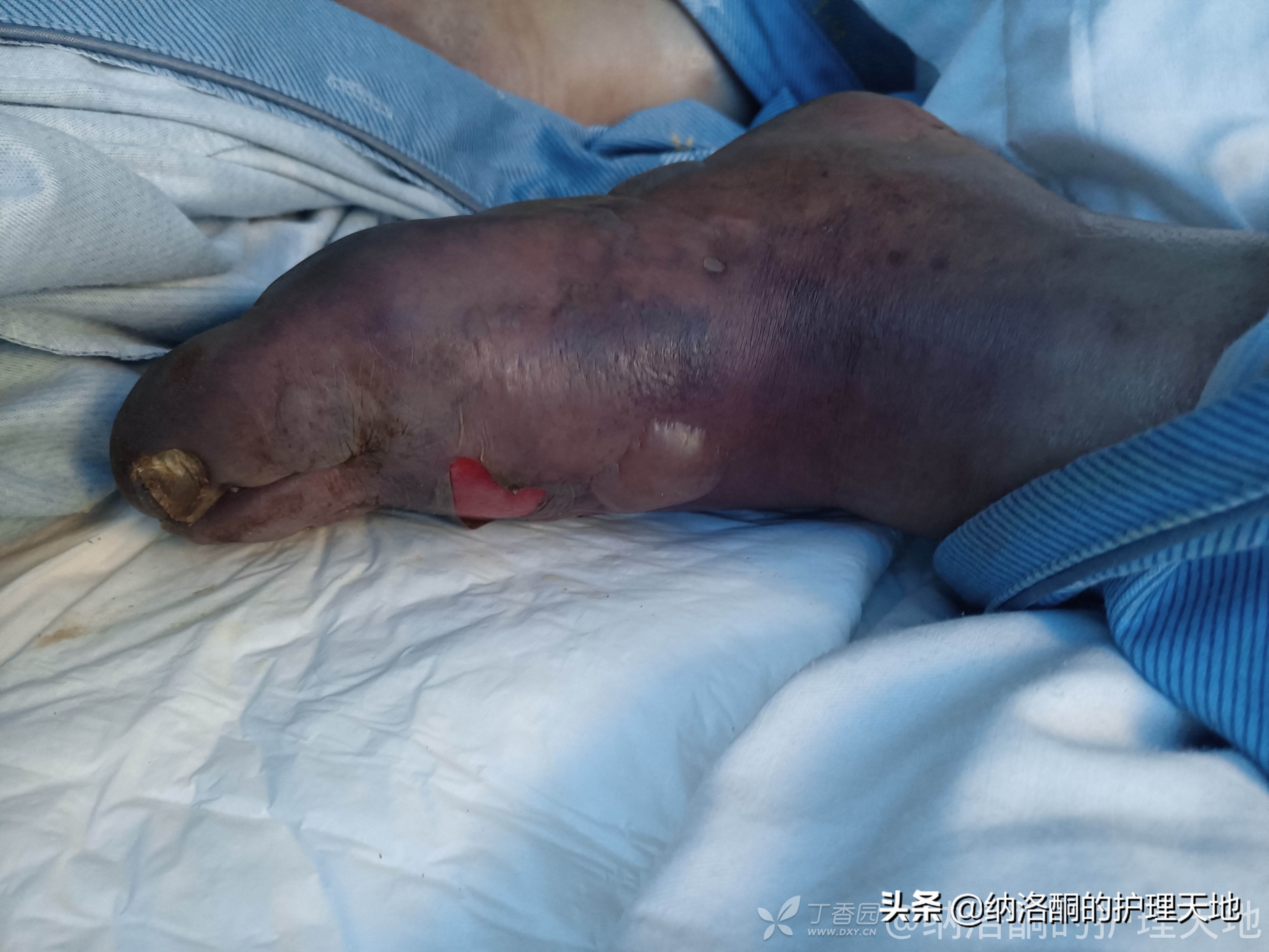 遇到水渍该怎么办,遇到水泡车该如何解决