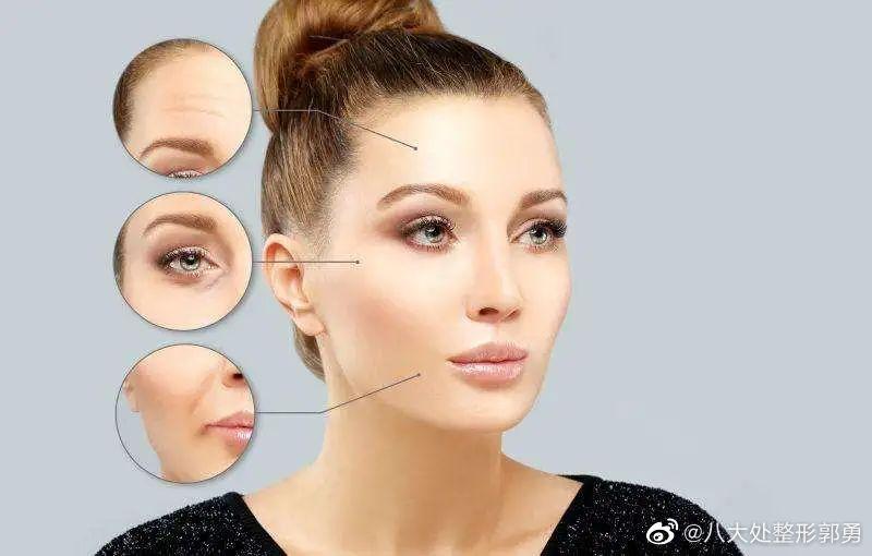 川字纹法令纹最好治疗方法,35岁法令纹类型