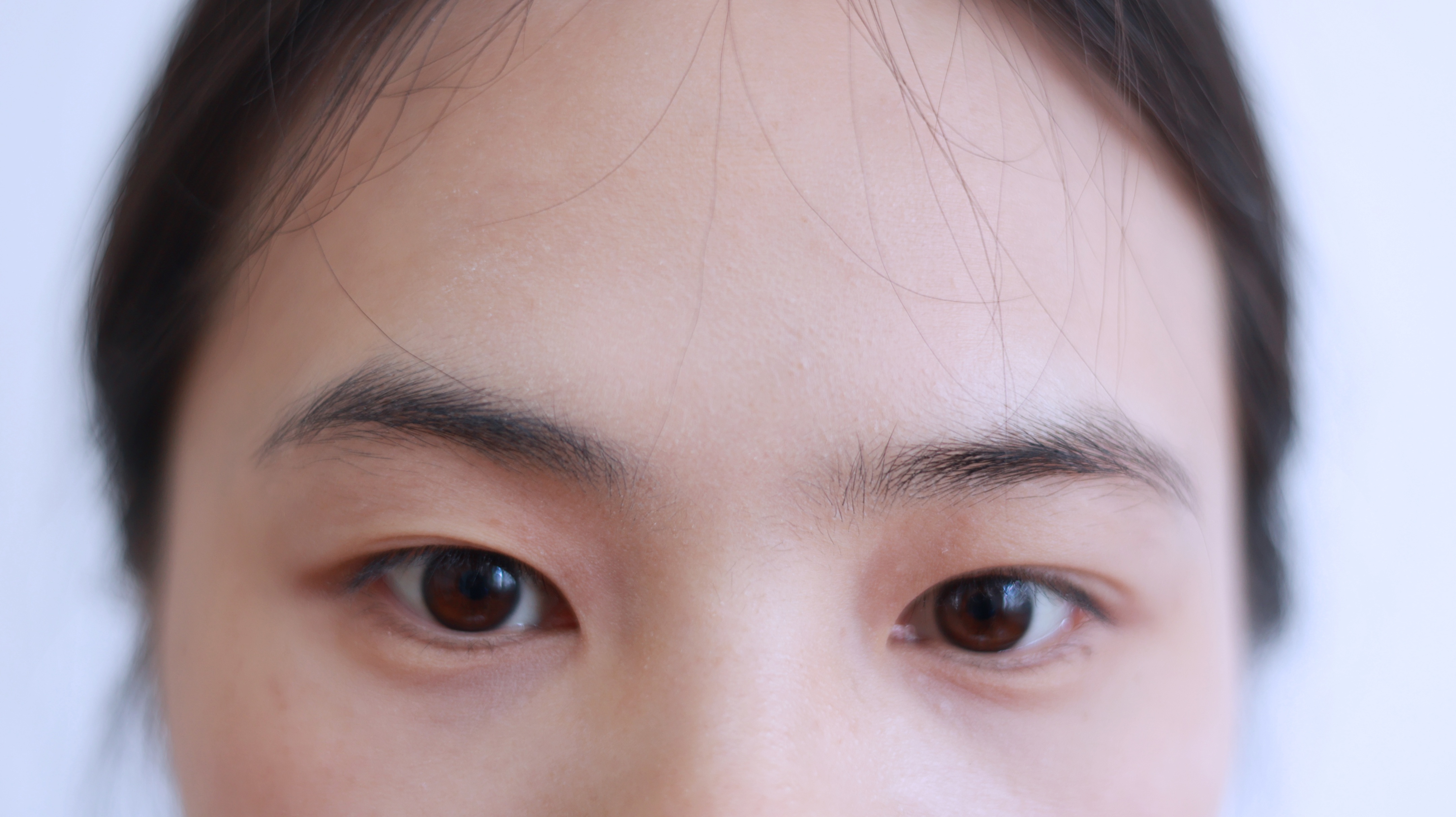 最近没怎么熬夜为什么眼袋很深,没有熬夜有眼袋怎么回事