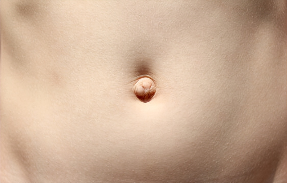 为什么抠肚脐眼肚子痛怎么缓解,抠肚脐眼肠子疼