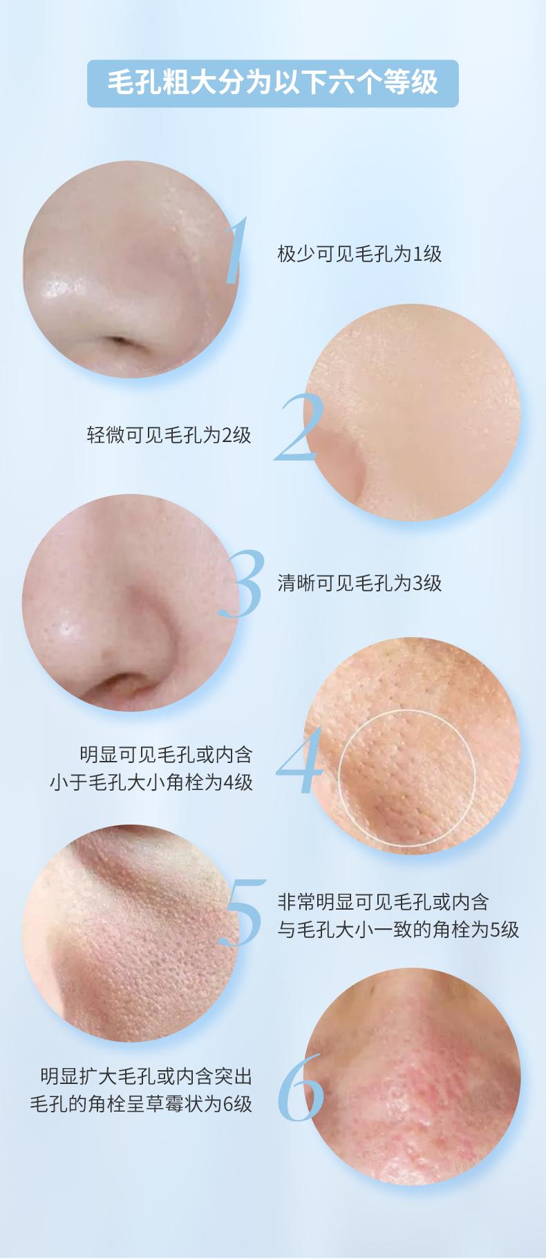 毛孔大得像“筛子”，你的毛孔是怎么一步步撑大的？