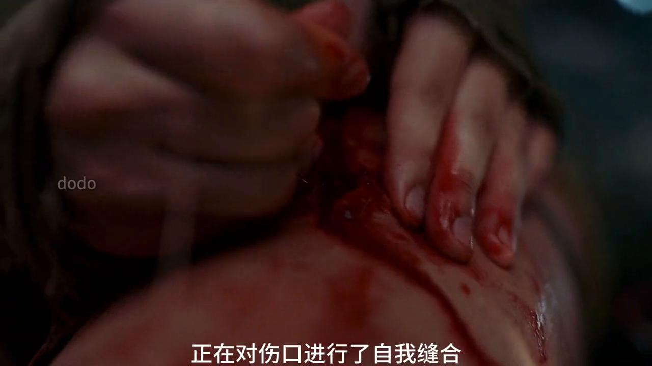 这个女人竟然自己缝合受伤的大腿#电影解说
