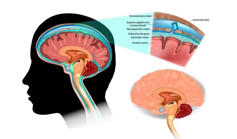 特发性颅内高压，是否会影响肥胖儿童的骨骼发育和身高增长？