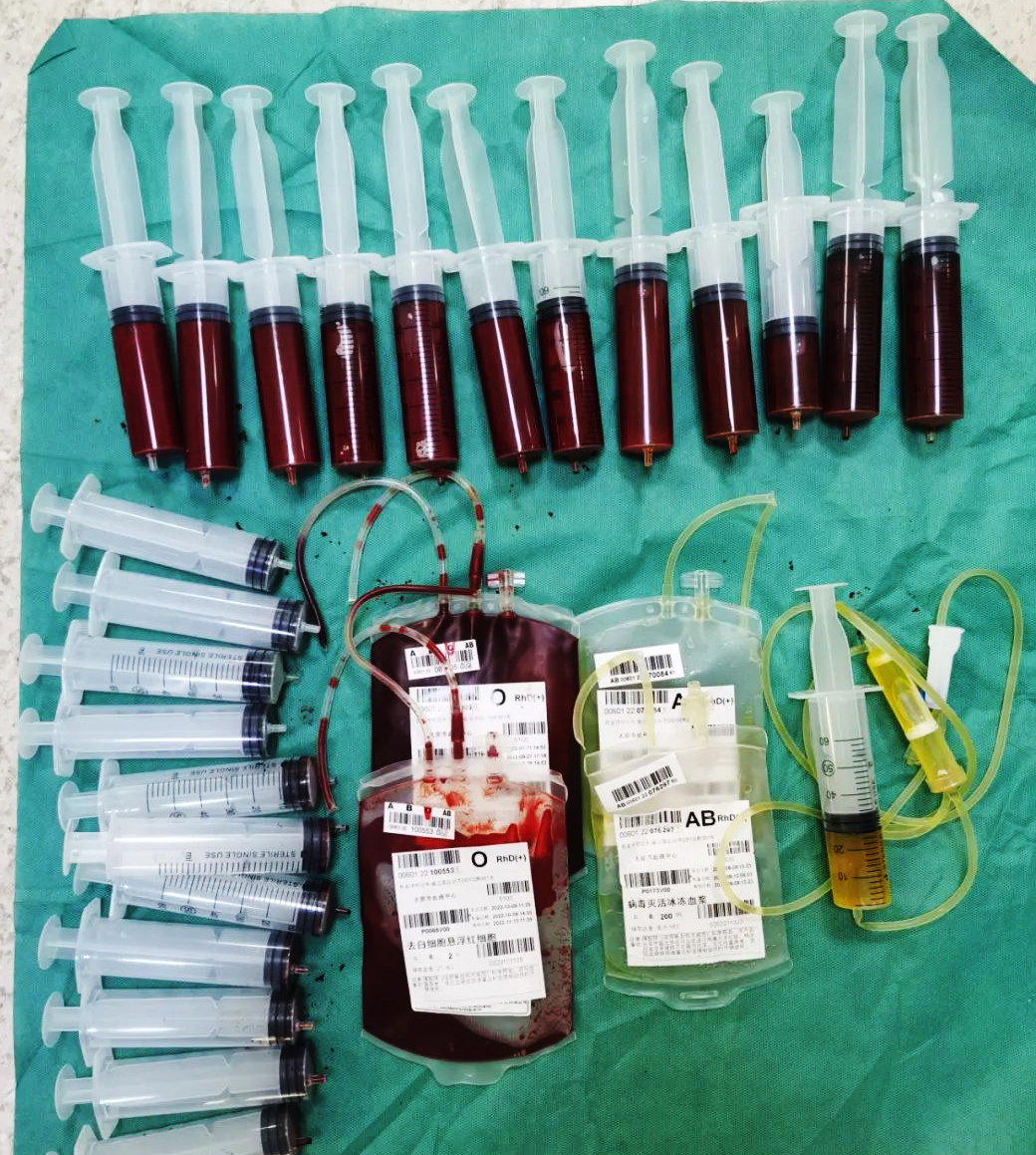 争分夺秒！太原白衣天使为新生儿“换血”