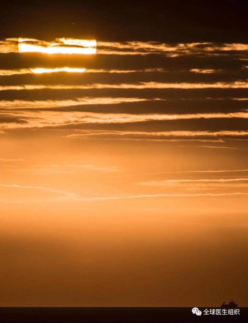 新冠哪些关节会痛得厉害,新冠的关节痛是怎样的