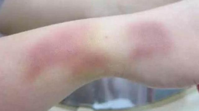 如果你女儿被家暴了,如果你女儿被人打怎么办