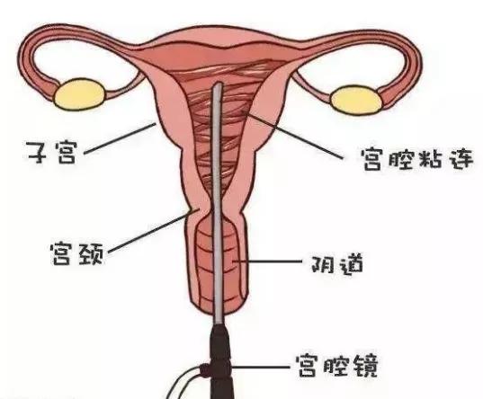 如果想要好孕需要注意哪些细节呢,想要好孕这些问题千万得注意