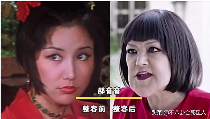 明星整容脸僵硬图片,老女明星整容脸和纯天然脸