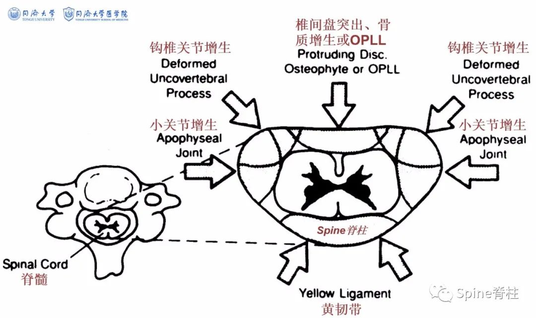 脊柱神经支配疼痛区域,脊柱神经支配的脏腑