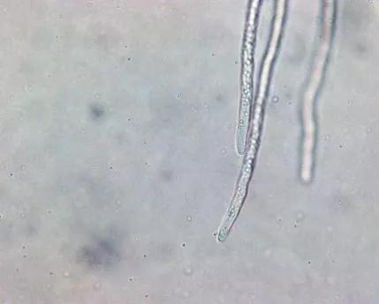水产养殖霉菌怎么处理,水产养殖杀水霉方法