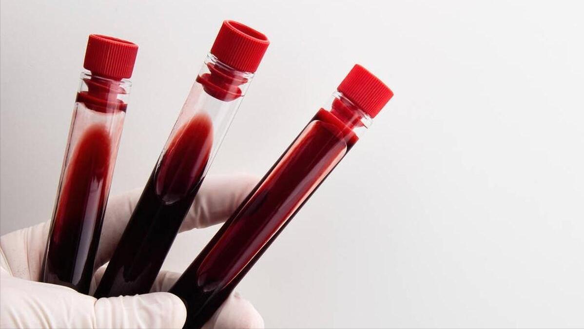 孕妇验血知怀孕天数,验血如何看孕妇孩子是否健康