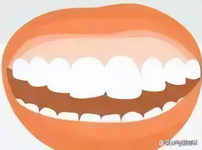 笑露牙龈怎么通过日常改善,为什么有些人笑起来露牙龈