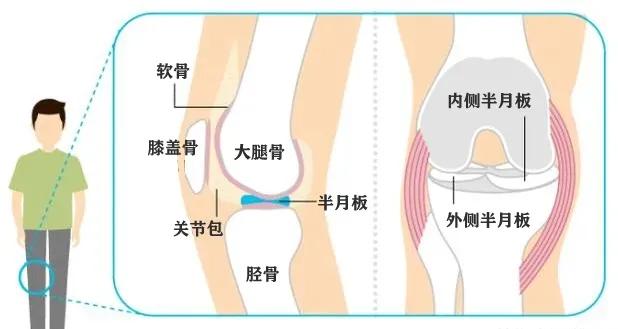 膝盖内侧肿痛是半月板损伤吗,膝盖酸软卡卡的响是什么情况