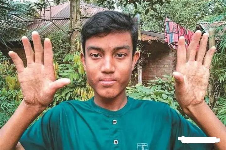 斗和簸箕的科学解释,斗纹和簸箕的科学论证