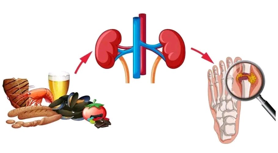 尿酸486吃非布司他20mg还是40mg,吃非布司他真的可以降尿酸吗