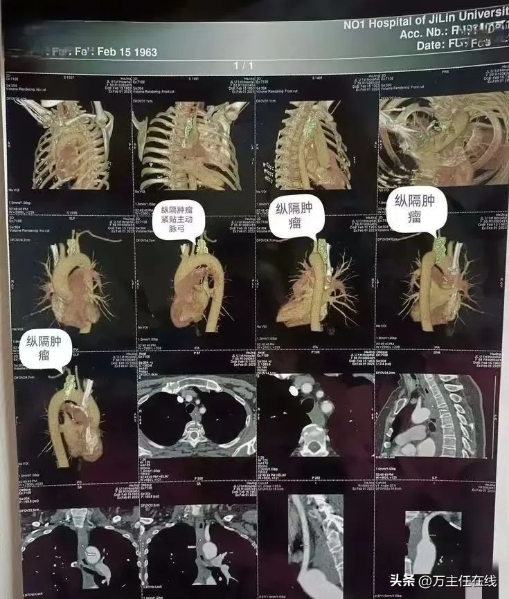 上海第一人民医院消化科万荣教授,消化内科专家手术