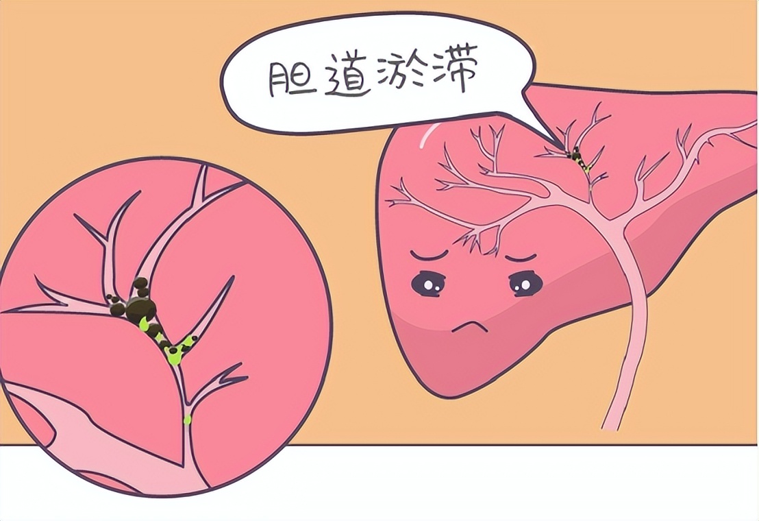 全身炎症反应会导致多器官功能障碍综合征，中西医如何治疗？