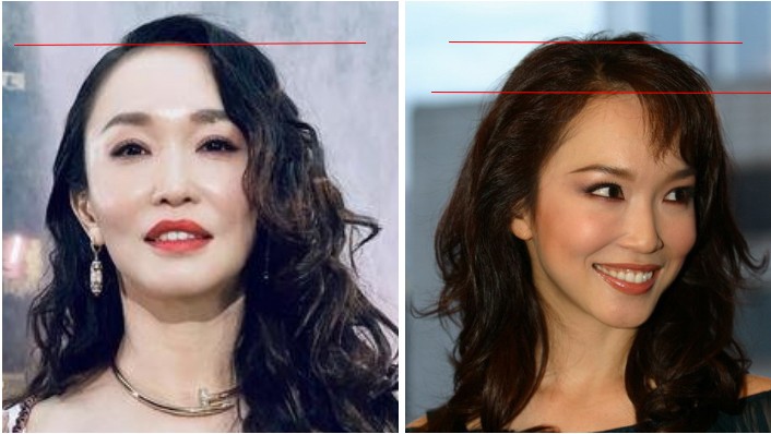 塌鼻子变美思路看这里,塌鼻梁怎么变漂亮