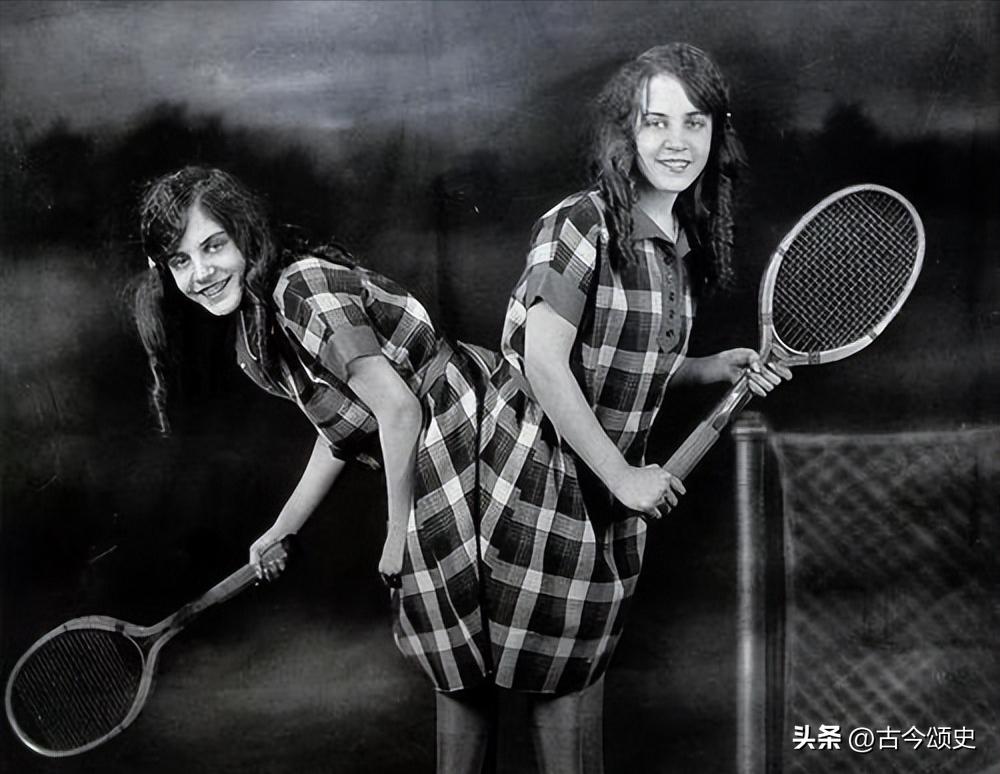 连体人结婚生子,连体人如何生子