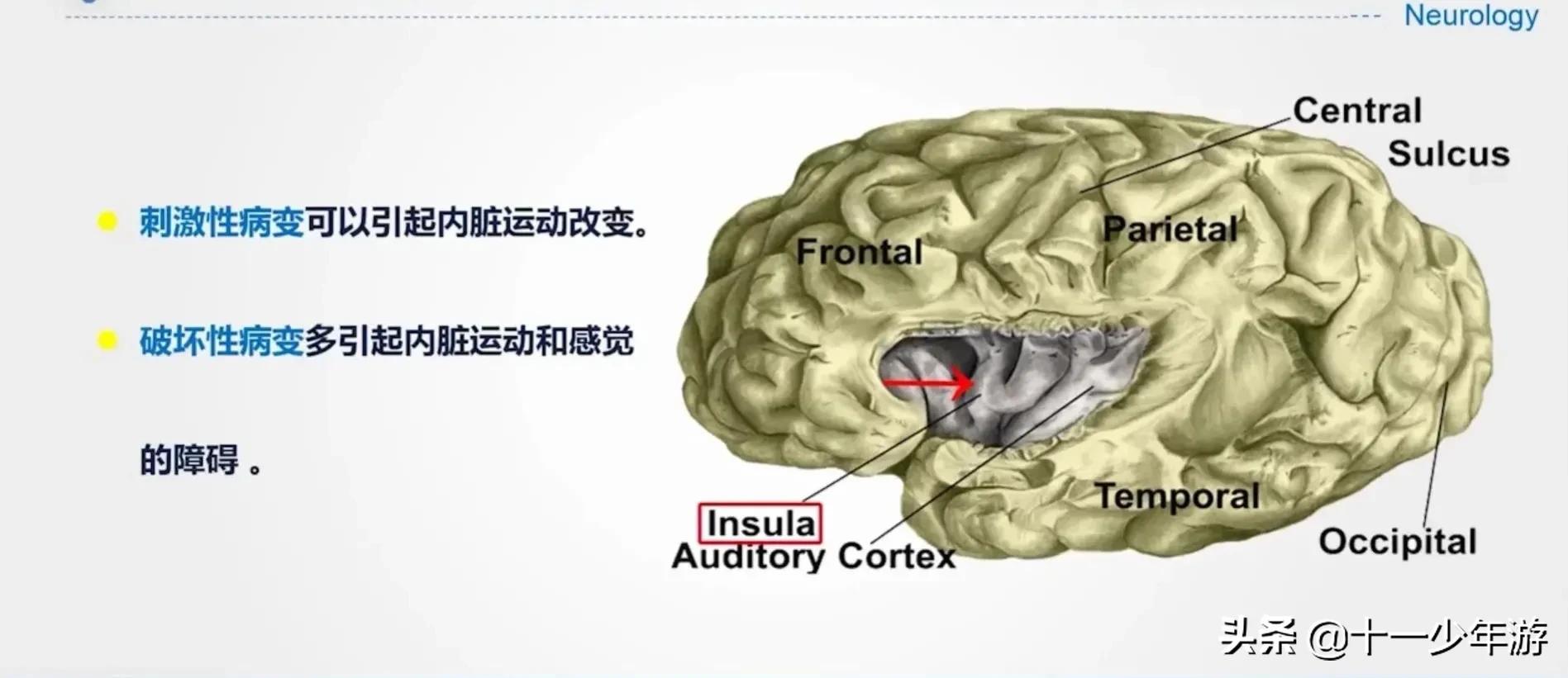 大脑的结构解剖示意图,大脑镰下疝解剖结构