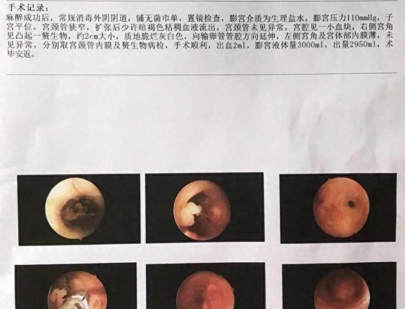 绝经两年后又见红，先生反复念叨“你受罪了”