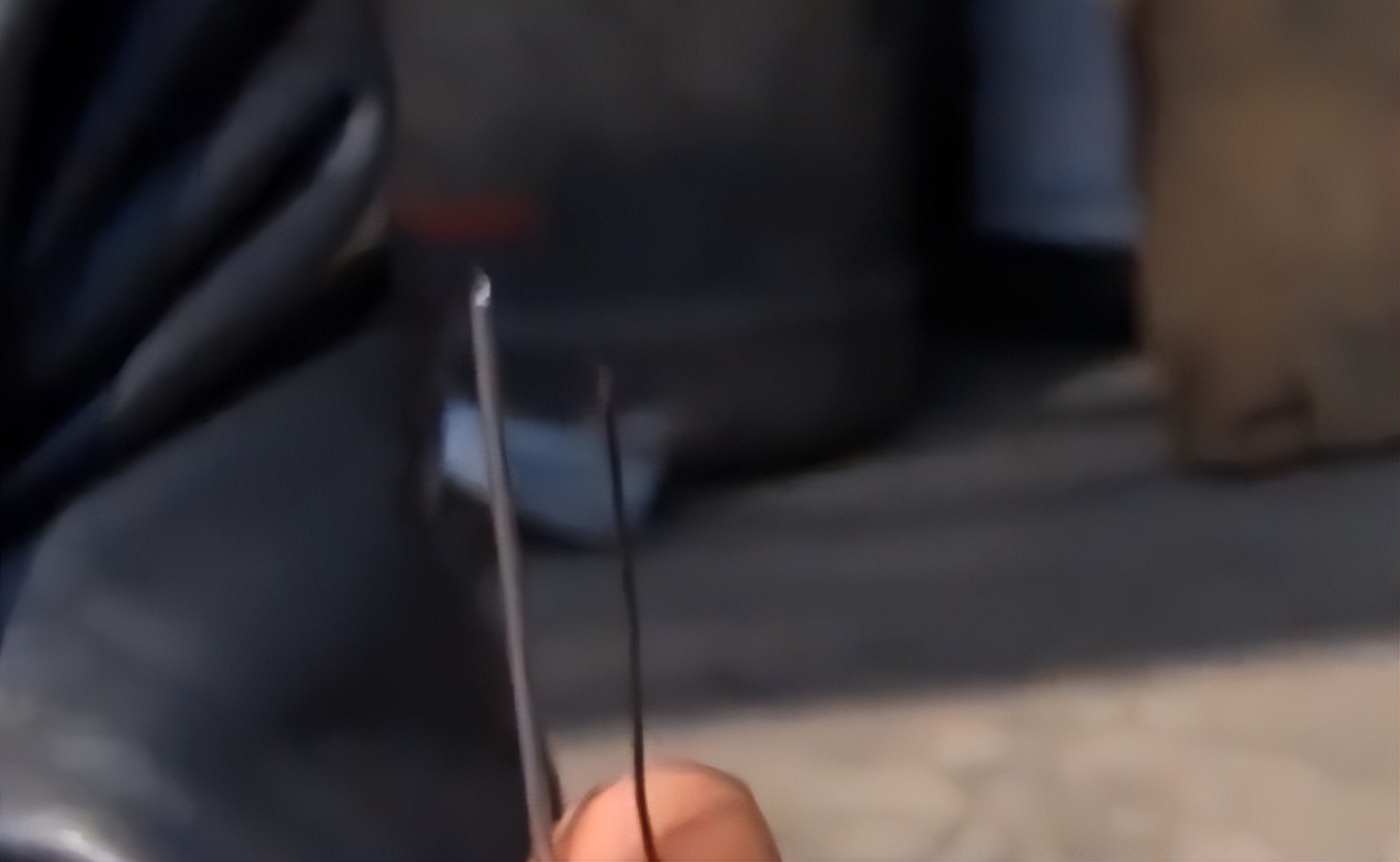 17岁男孩头痛被送进医院，医生一看X光片直接傻眼：没救了