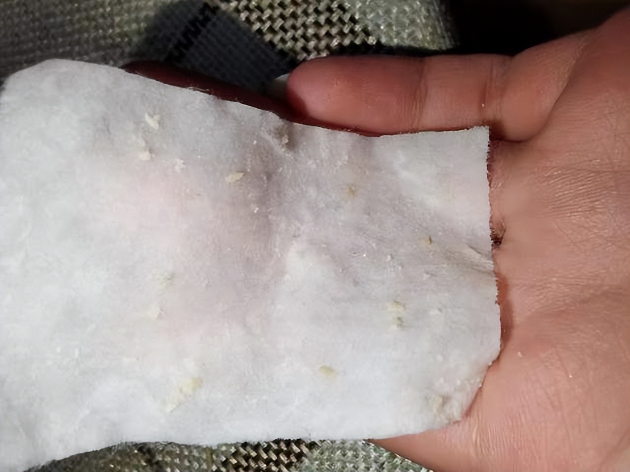 眉心鼻翼和下巴长粉刺为什么,鼻头上起粉刺什么原因引起的图片