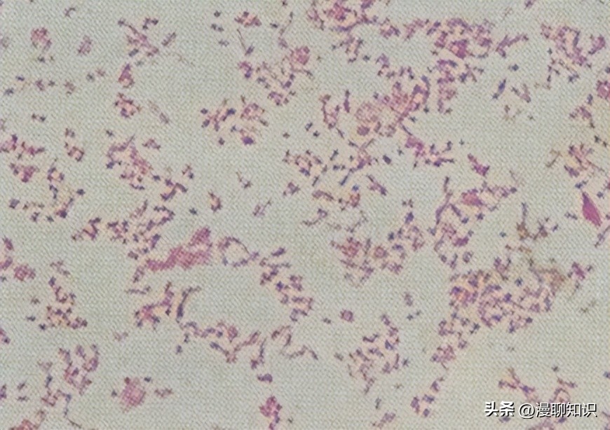 副猪嗜血杆菌是一种巴氏杆菌，其生长依赖于V因子，还有其他的吗