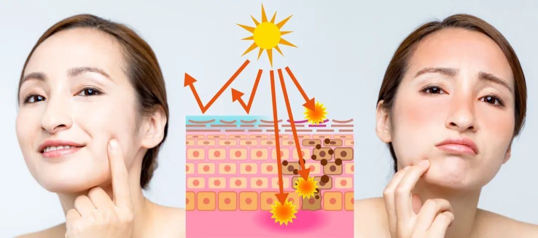 进入冬季皮肤瘙痒是什么原因,入春脸特别痒