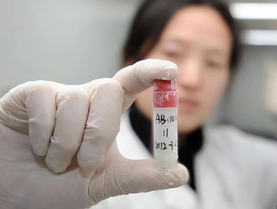 男性长期精子不代谢,男性精子10年不释放会有何后果