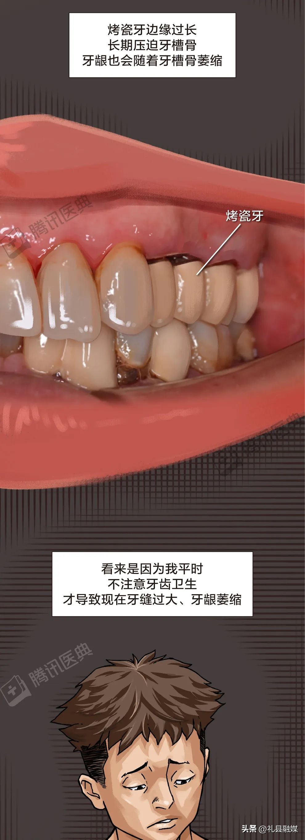 牙齿吃肉总是塞牙怎么治疗,吃肉吃菜老是塞牙怎么办