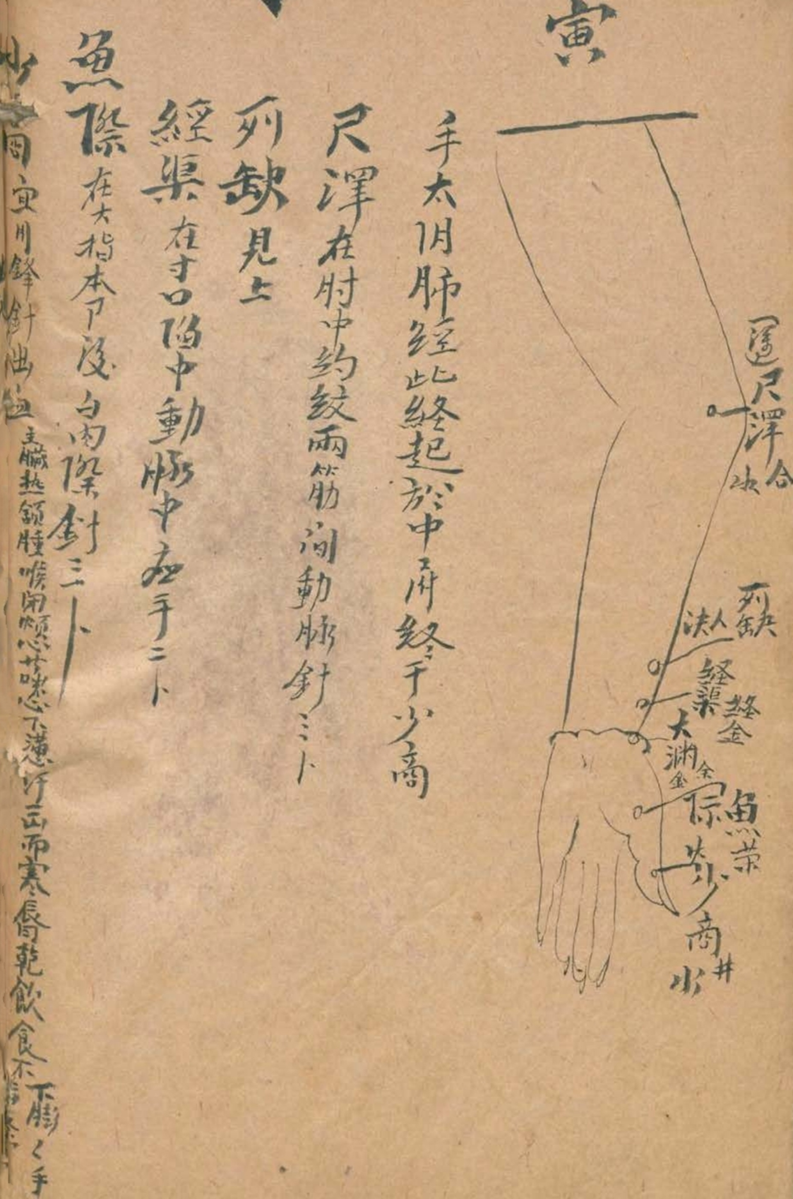 放痧疗法视频,放痧的最佳方法