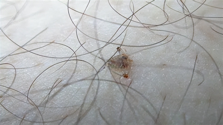 7岁男孩眼睛发红还痒是怎么回事,4岁男童眼睛偶尔痒痒是怎么回事