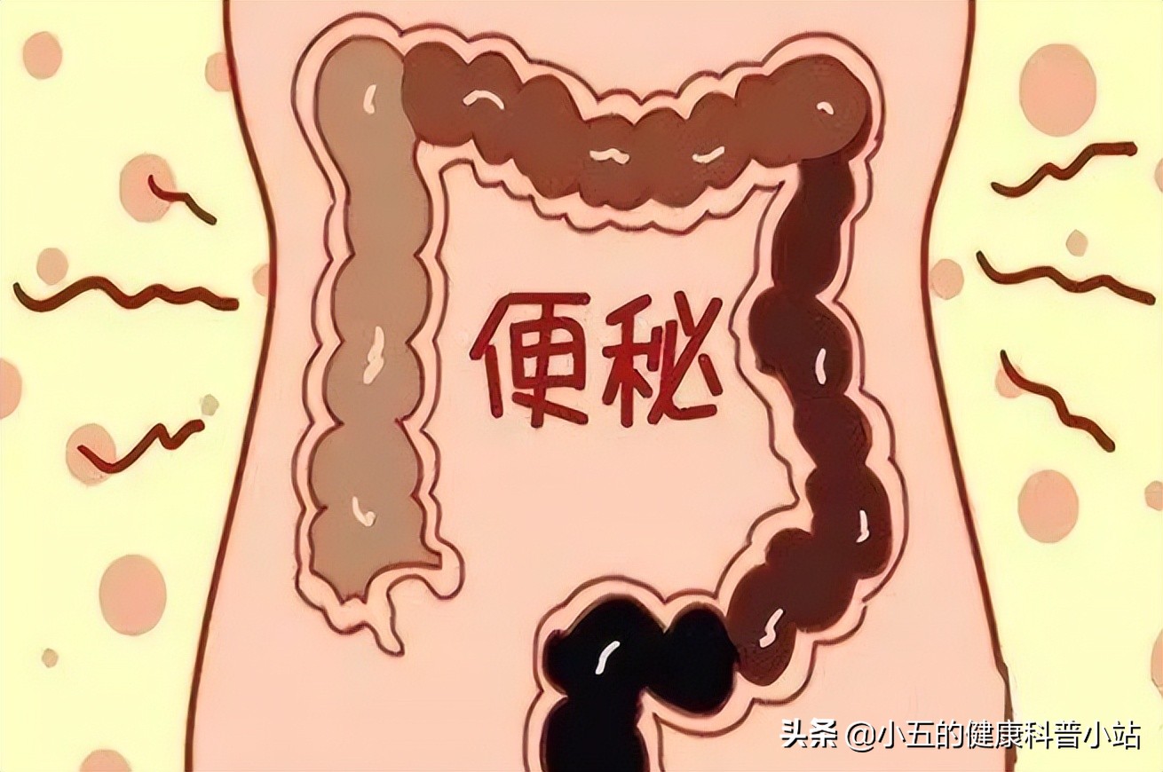 开塞露治便秘的正确方法,开塞露治便秘的过程