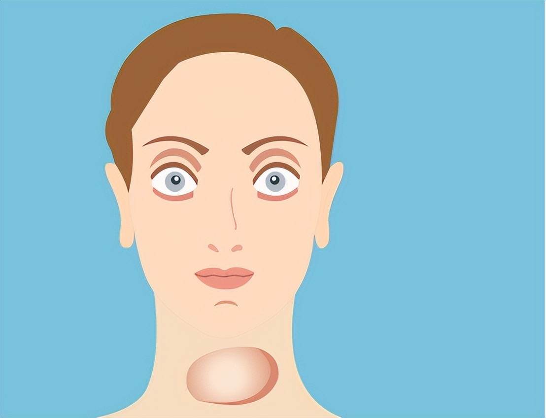 甲亢引起焦虑抑郁症怎么办,甲亢引起焦虑症