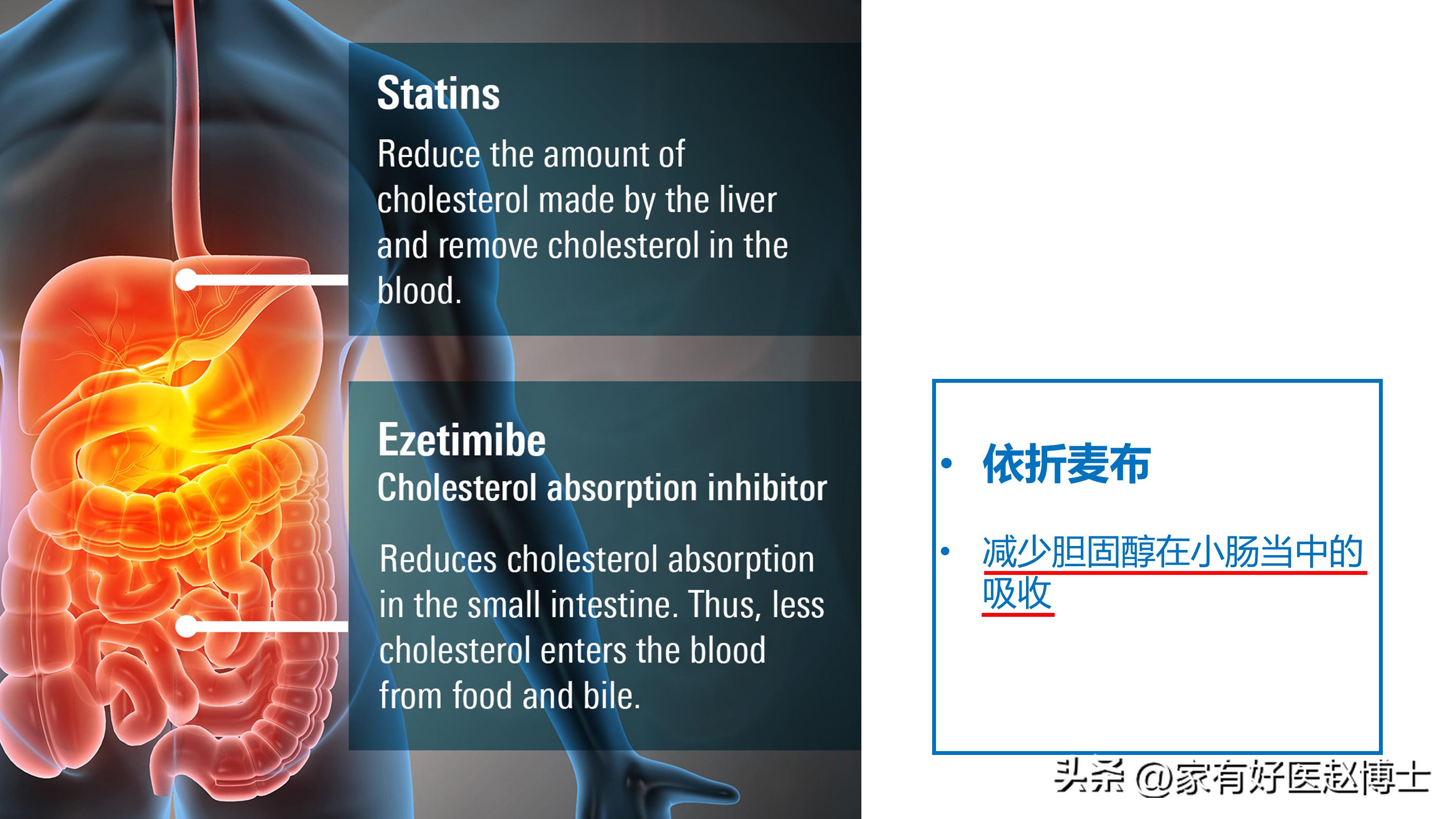 他汀药与依折麦布能同服吗,他汀和血脂康一样有效吗