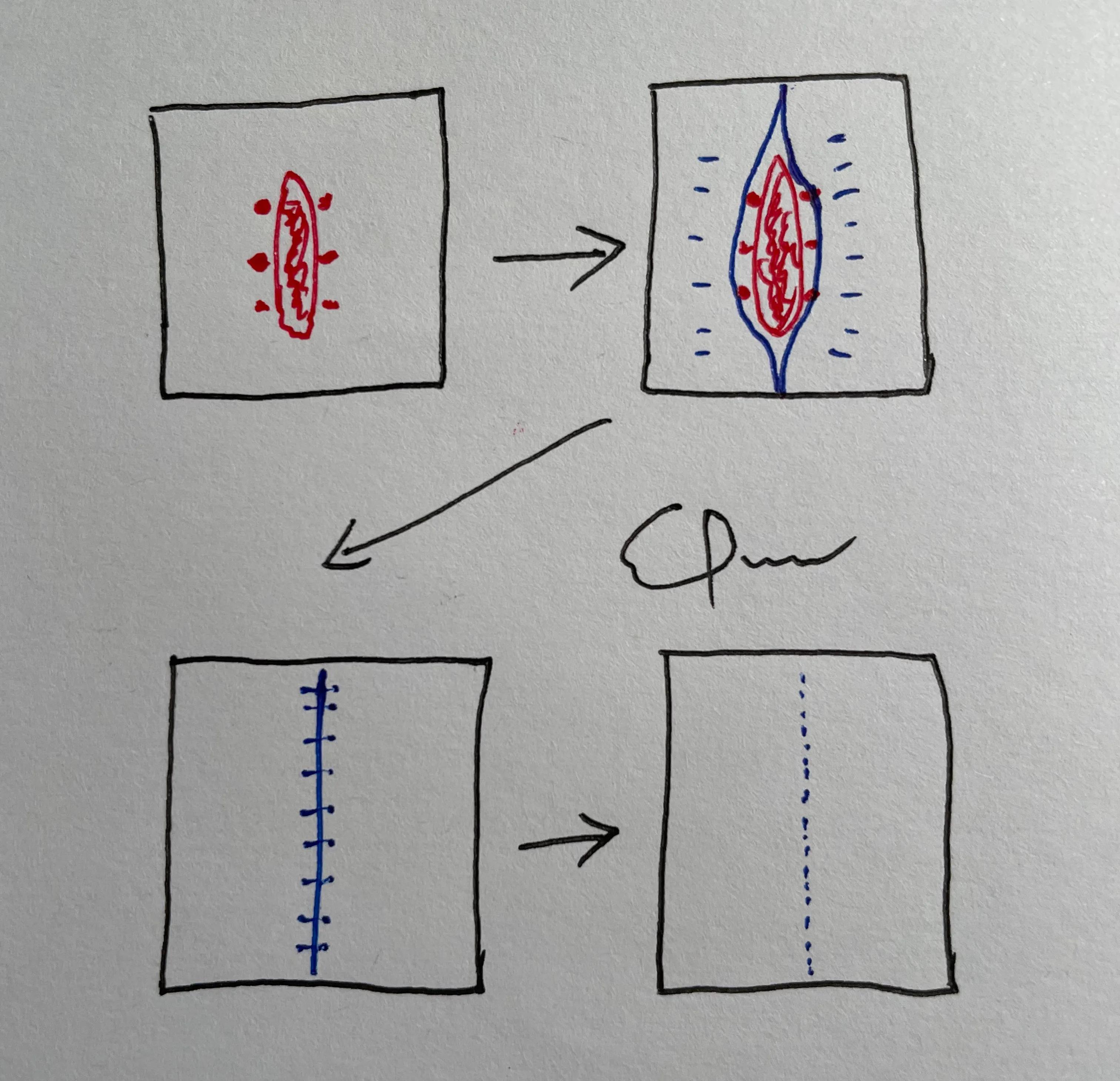 身上有疤痕吗三分钟了解祛疤方法,身上有疤痕医院怎么去除