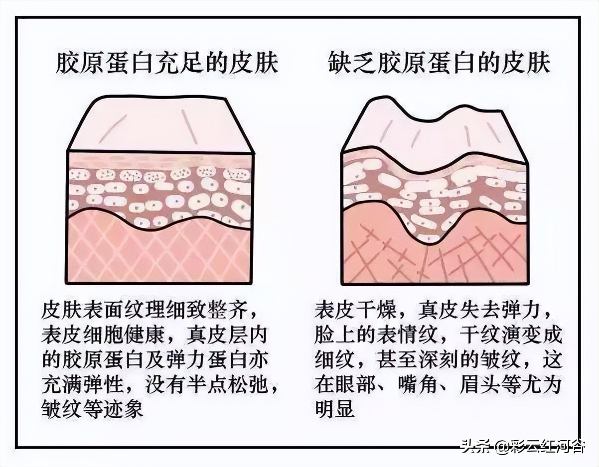 胶原蛋白是不是长期才有效,胶原蛋白什么年龄开始补
