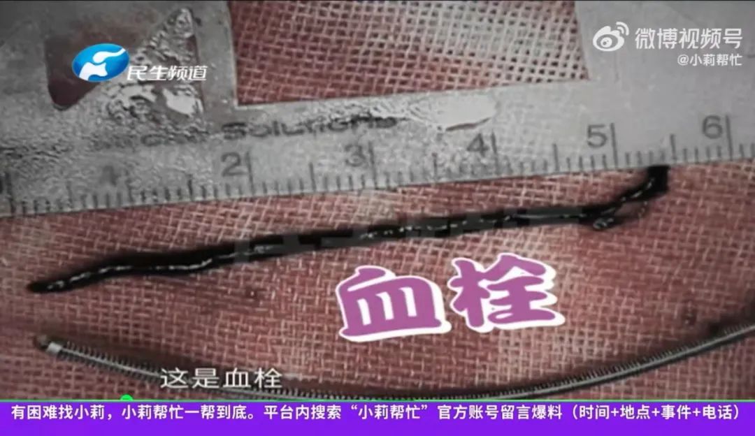 吃避孕药改善痘痘月经期还要吃吗,避孕药没效果会不会来大姨妈